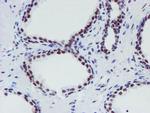 METT10D Antibody in Immunohistochemistry (Paraffin) (IHC (P))