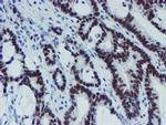 METT10D Antibody in Immunohistochemistry (Paraffin) (IHC (P))