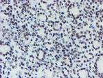 METT10D Antibody in Immunohistochemistry (Paraffin) (IHC (P))