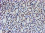 ACSF2 Antibody in Immunohistochemistry (Paraffin) (IHC (P))