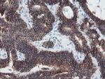 SRPRB Antibody in Immunohistochemistry (Paraffin) (IHC (P))