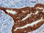 FXYD3 Antibody in Immunohistochemistry (Paraffin) (IHC (P))