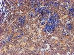 FXYD3 Antibody in Immunohistochemistry (Paraffin) (IHC (P))