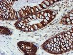 FXYD3 Antibody in Immunohistochemistry (Paraffin) (IHC (P))