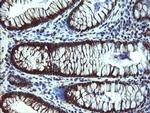 TBCC Antibody in Immunohistochemistry (Paraffin) (IHC (P))