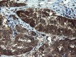 TBCC Antibody in Immunohistochemistry (Paraffin) (IHC (P))