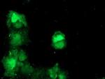 TBCC Antibody in Immunocytochemistry (ICC/IF)