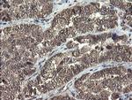 TBCC Antibody in Immunohistochemistry (Paraffin) (IHC (P))