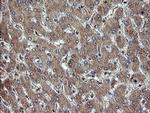 TBCC Antibody in Immunohistochemistry (Paraffin) (IHC (P))