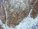 PPAT Antibody in Immunohistochemistry (Paraffin) (IHC (P))