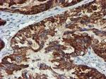 PPAT Antibody in Immunohistochemistry (Paraffin) (IHC (P))