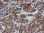 PPAT Antibody in Immunohistochemistry (Paraffin) (IHC (P))