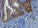 PPAT Antibody in Immunohistochemistry (Paraffin) (IHC (P))