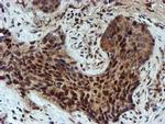 NQO2 Antibody in Immunohistochemistry (Paraffin) (IHC (P))