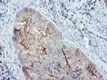 Syntenin 1 Antibody in Immunohistochemistry (Paraffin) (IHC (P))