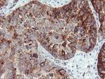 Syntenin 1 Antibody in Immunohistochemistry (Paraffin) (IHC (P))