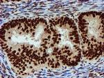 PADI4 Antibody in Immunohistochemistry (Paraffin) (IHC (P))