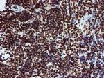 PADI4 Antibody in Immunohistochemistry (Paraffin) (IHC (P))