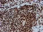 PADI4 Antibody in Immunohistochemistry (Paraffin) (IHC (P))