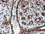 PADI4 Antibody in Immunohistochemistry (Paraffin) (IHC (P))