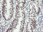 SENP2 Antibody in Immunohistochemistry (Paraffin) (IHC (P))