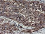 DPH2 Antibody in Immunohistochemistry (Paraffin) (IHC (P))