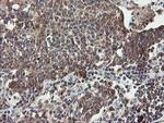 DPH2 Antibody in Immunohistochemistry (Paraffin) (IHC (P))