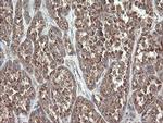 DPH2 Antibody in Immunohistochemistry (Paraffin) (IHC (P))