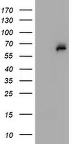 PGM3 Antibody in Western Blot (WB)