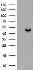 ADH7 Antibody in Western Blot (WB)