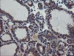 VBP1 Antibody in Immunohistochemistry (Paraffin) (IHC (P))