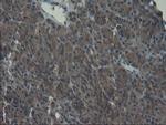 VBP1 Antibody in Immunohistochemistry (Paraffin) (IHC (P))