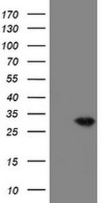 VBP1 Antibody in Western Blot (WB)