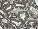 COMMD1 Antibody in Immunohistochemistry (Paraffin) (IHC (P))