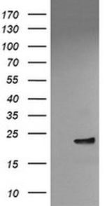 VBP1 Antibody in Western Blot (WB)