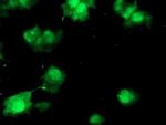 COMMD1 Antibody in Immunocytochemistry (ICC/IF)