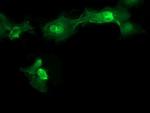 MMACHC Antibody in Immunocytochemistry (ICC/IF)