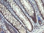 MMACHC Antibody in Immunohistochemistry (Paraffin) (IHC (P))