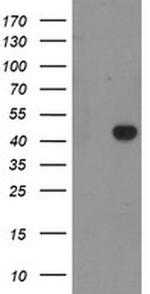 RAB3IL1 Antibody in Western Blot (WB)