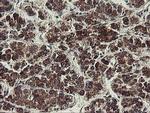 UBE2J1 Antibody in Immunohistochemistry (Paraffin) (IHC (P))