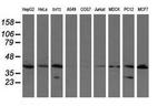 UBE2J1 Antibody in Western Blot (WB)