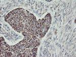 C1orf151 Antibody in Immunohistochemistry (Paraffin) (IHC (P))