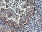 C1orf151 Antibody in Immunohistochemistry (Paraffin) (IHC (P))