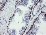 STING Antibody in Immunohistochemistry (Paraffin) (IHC (P))