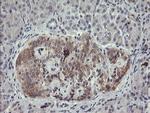 eIF5A2 Antibody in Immunohistochemistry (Paraffin) (IHC (P))