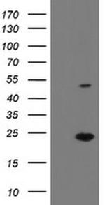 eIF5A2 Antibody in Western Blot (WB)