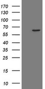 POLR3C Antibody in Western Blot (WB)