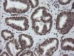 CHN1 Antibody in Immunohistochemistry (Paraffin) (IHC (P))