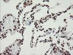 CHN1 Antibody in Immunohistochemistry (Paraffin) (IHC (P))