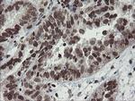 CHN1 Antibody in Immunohistochemistry (Paraffin) (IHC (P))